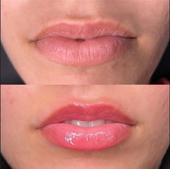 LABIAL LIP ENGROSADOR DE LABIOS